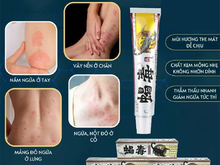 thuốc da liễu tuệ tâm